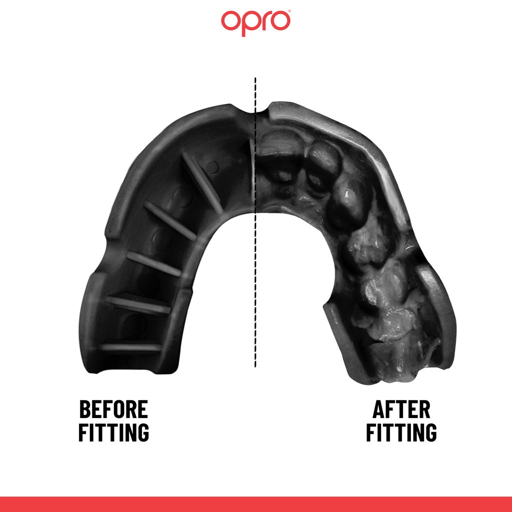 Opro Bronze Mouth Guard - Adults - Black